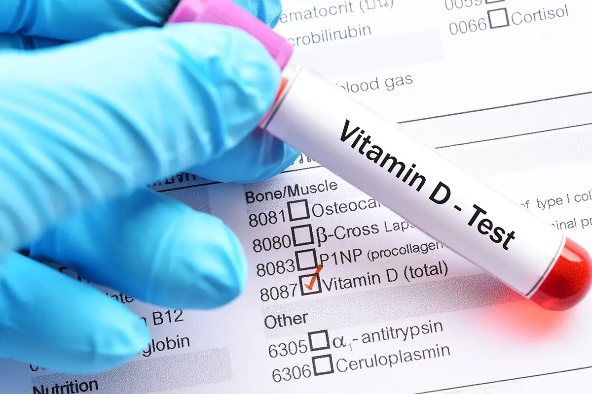 How to Spot a Vitamin D Deficiency?